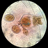 Live Rotifers 500K (Small Strian) Brachionus Rotundiformis
